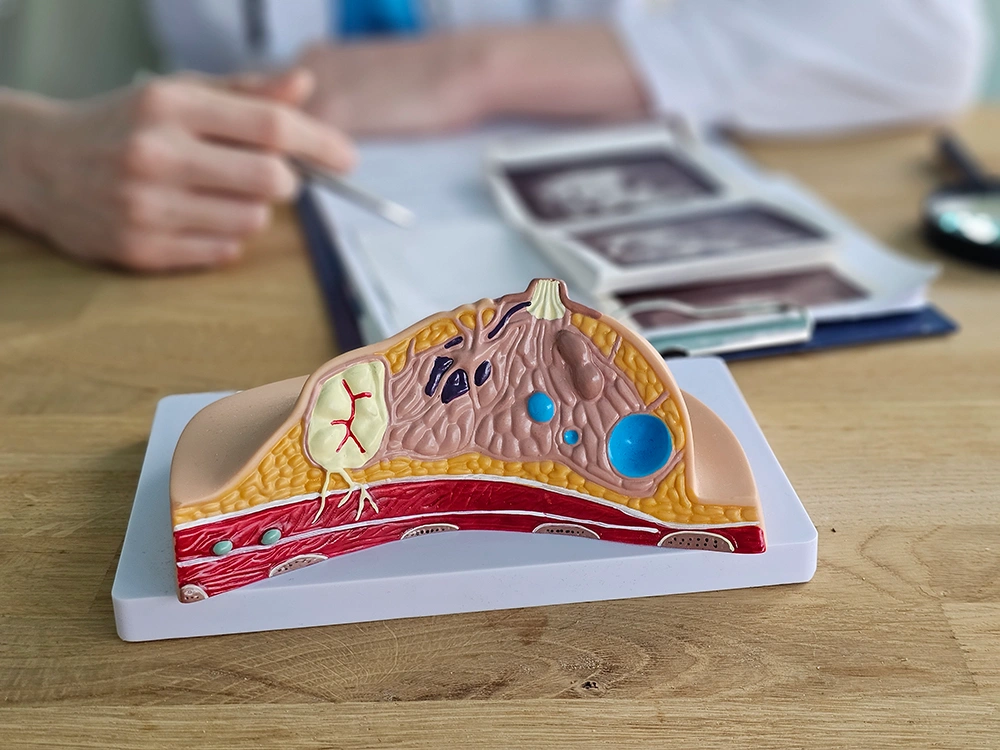 A specialist explaining breast cancer surgery options during a consultation
