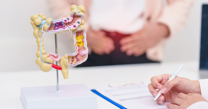 What to Expect from Colorectal Cancer Surgery