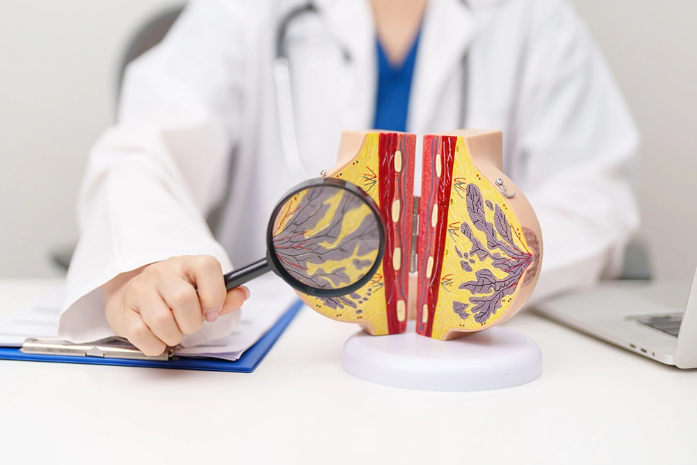 Doctor explaining breast cancer using a breast model