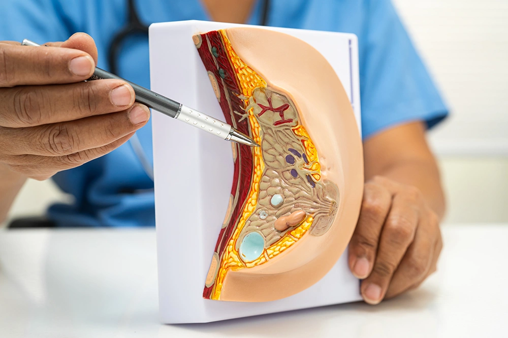 A specialist referring to a model of the human breast in a consultation for breast cancer care