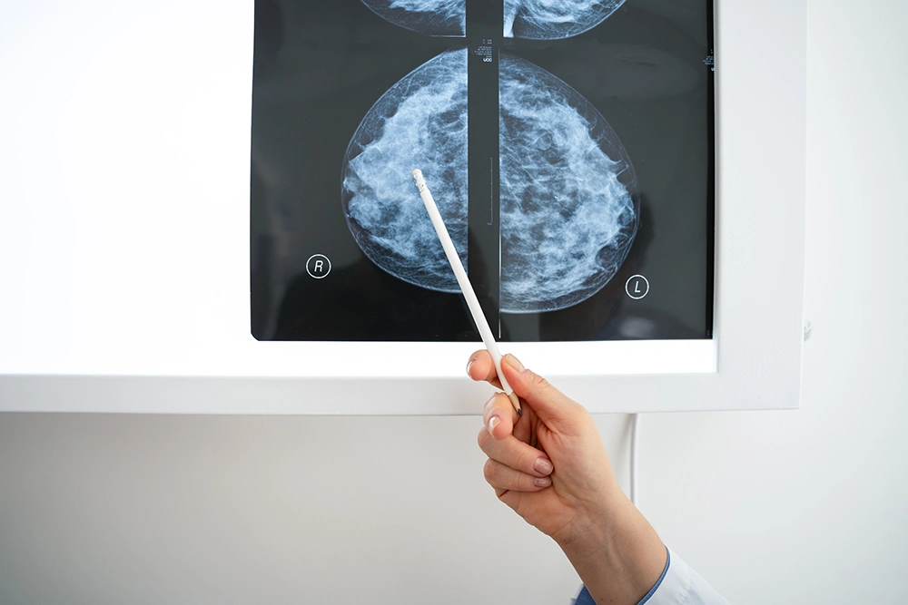 doctor reviewing the results of a mammogram